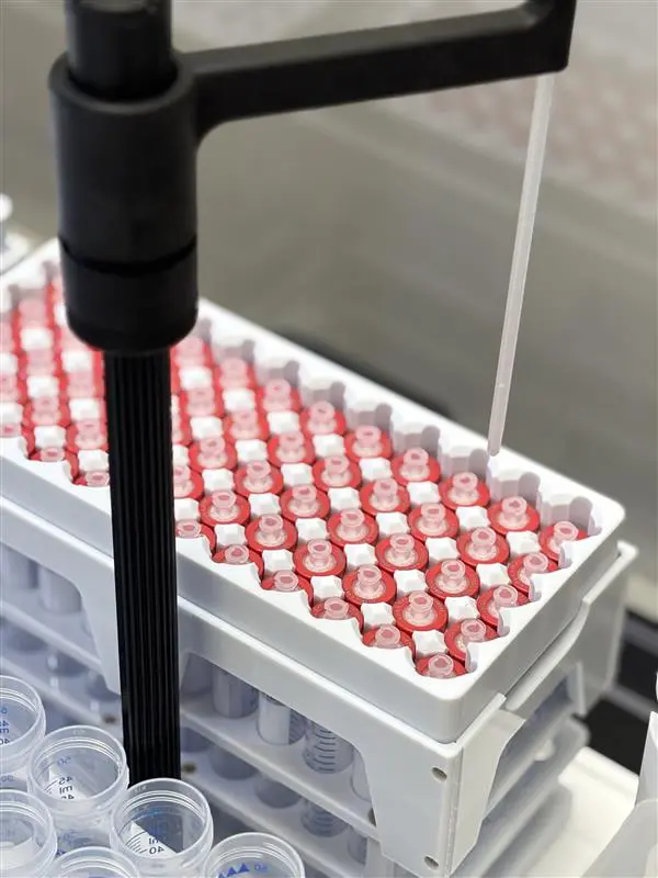 Control your sample preparation & streamline analysis